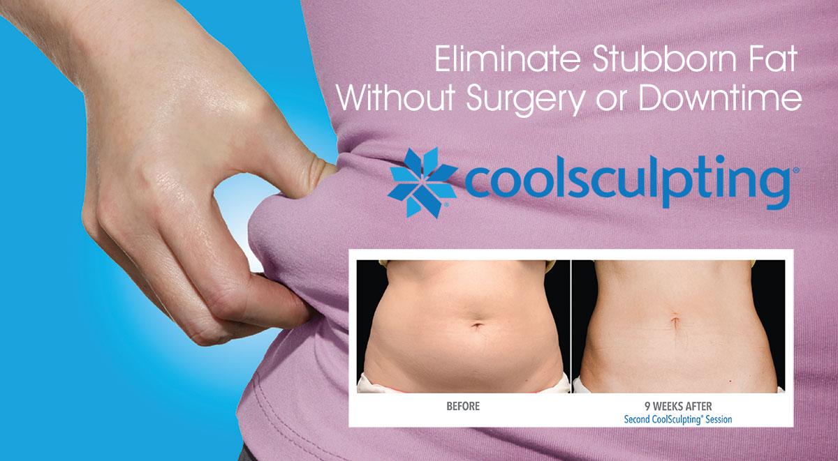 CoolSculptin Eliminate Stubborn Fat without Surgery of Downtime
